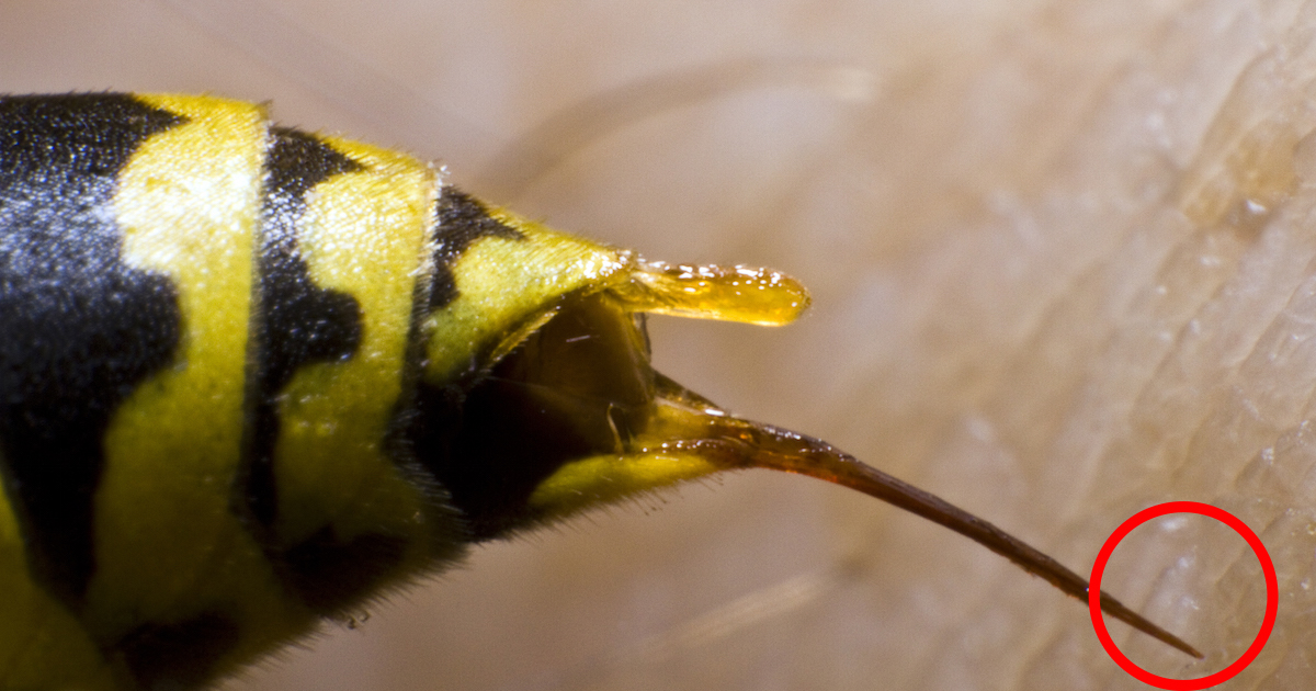 Bienenstich Wie Lange Schwellung Captions Profile
