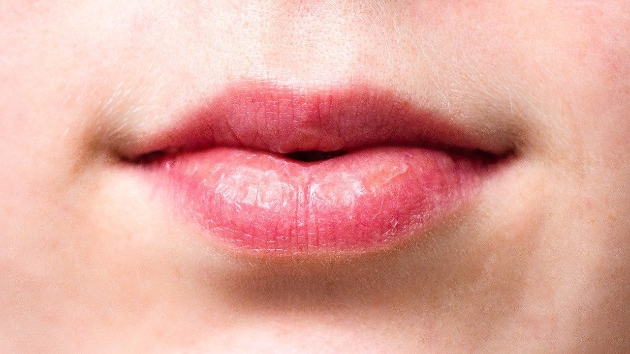 Lippe flecken auf der Braune Flecken